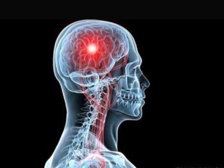 ΕΓΚΕΦΑΛΙΚΌ ΕΠΕΙΣΌΔΙΟ ΚΑΙ ΑΠΏΛΕΙΑ ΟΡΑΣΗΣ