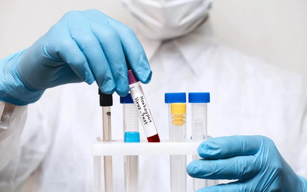 ΠΡΟΣ ΝΈΑ “Π(Λ)ΑΝΔΗΜΊΑ ΤΩΝ ΠΙΘΉΚΩΝ”;